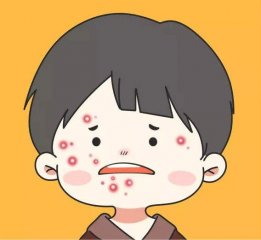 脸颊长痘痘有哪些类型