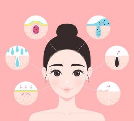 痘痘的主要特征是什么