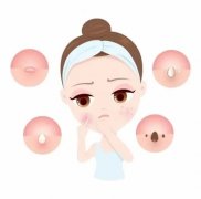 青春痘留下的疤痕怎么去除